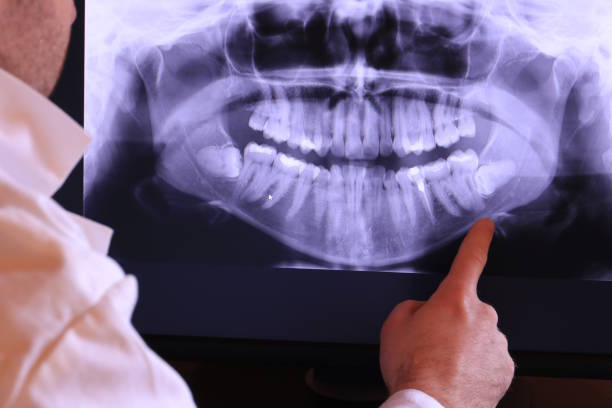 Best Emergency Tooth Extraction in Lake Carmel, NY